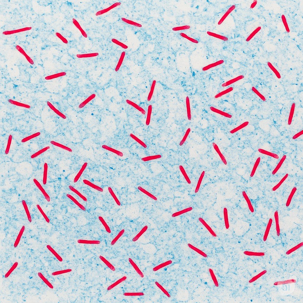 Coloraciones especiales 2